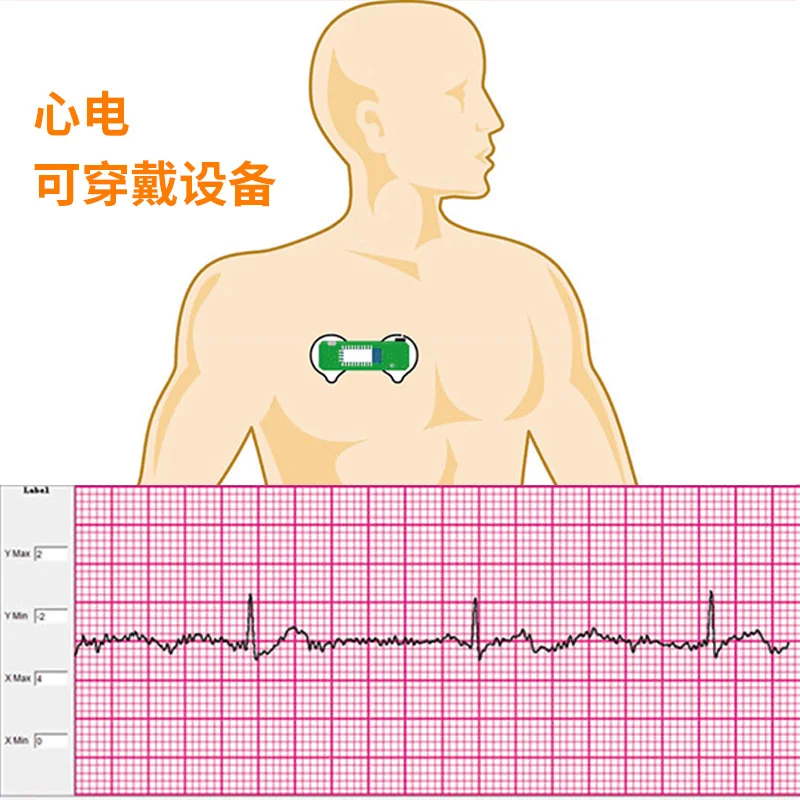 BMD101 ECG Electrocardiogram S - Ecg Patch Monitor recensione e prezzo