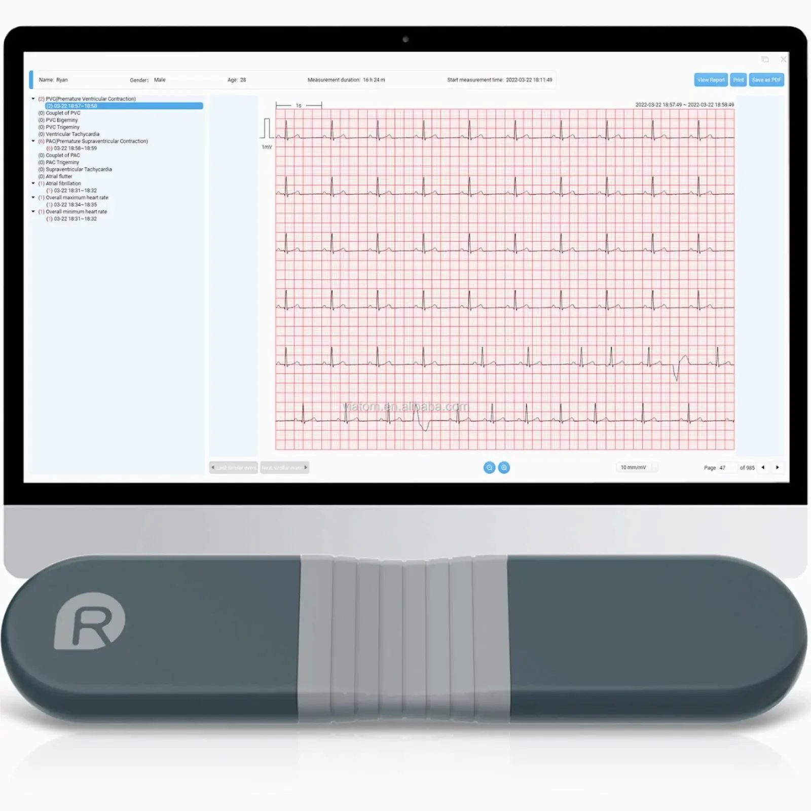 Wireless Bluetooth Dynamic Rec - Ecg Patch Monitor recensione e prezzo